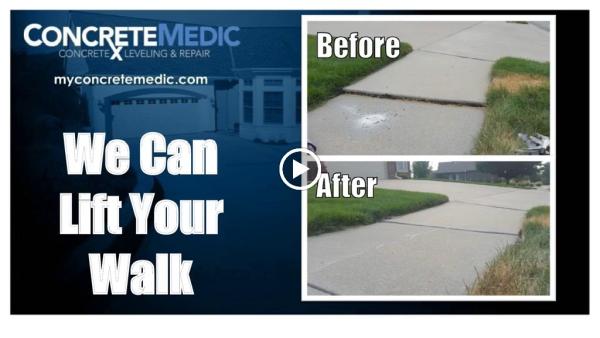Concretemedic